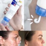 Mistine Acne Clear Face wash 85g - Image 2